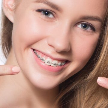Looking for an Orthodontist? Choose the Lancaster Orthodontist