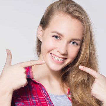 What to Know About Braces for Kids
