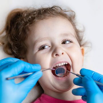 Do All Children Need Dental Sealants? 