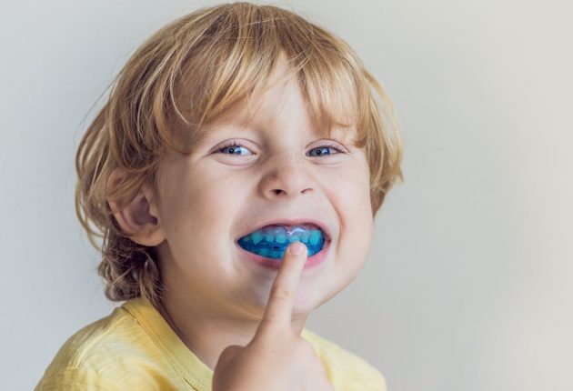 Mouth-Guards