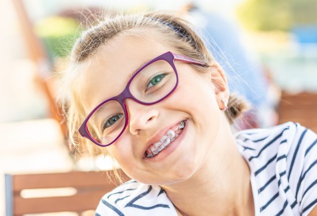 Traditional-Braces-1