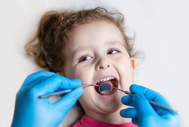 do all children need dental sealants